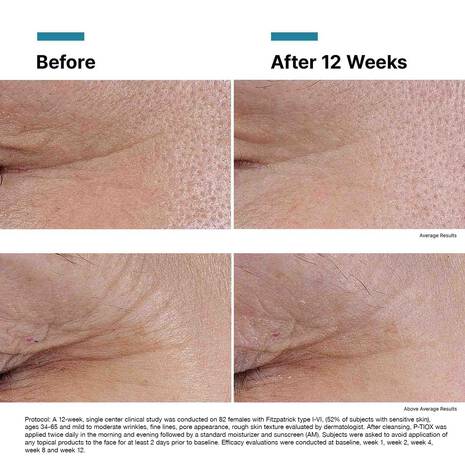 Skinceuticals P-TIOX Wrinkle-Modulating Peptide Serum 1.0oz/30ml