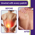 Relief Night Pain Patches: Arnica & Melatonin for Soreness & Sleep - 8 Pack