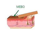 MEBO Burn Cream Skin Healing Ointment Wound & Scar No Marks Care Fast First Aid Health Beauty Care (1 Tube = 15 grams)
