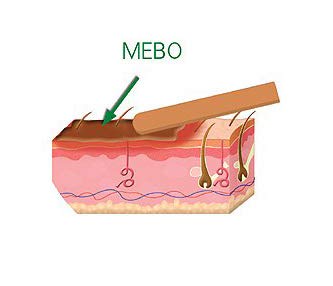 MEBO Burn Cream Skin Healing Ointment Wound & Scar No Marks Care Fast First Aid Health Beauty Care (1 Tube = 15 grams)