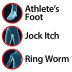 Miconazole Globe (3 Pack) Nitrate 2% Cream 1 oz, Cures Most Athletes Foot, Jock Itch, Ringworm and More.