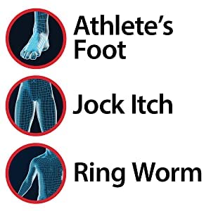 Miconazole Globe (3 Pack) Nitrate 2% Cream 1 oz, Cures Most Athletes Foot, Jock Itch, Ringworm and More.