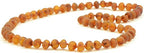 Baltic Amber Necklace for Adult - Natural Amber from Baltic Region, Genuine Baltic Amber (19.7 inch, RAW Cognac)
