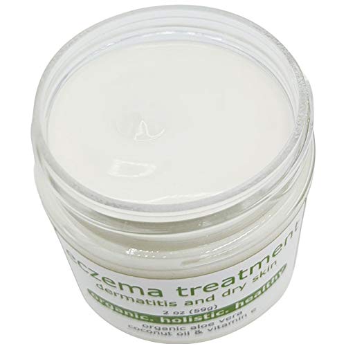 Made from Earth Eczema Cream for Dry Dermatitis Skin with Aloe & Vitamin E, 2oz