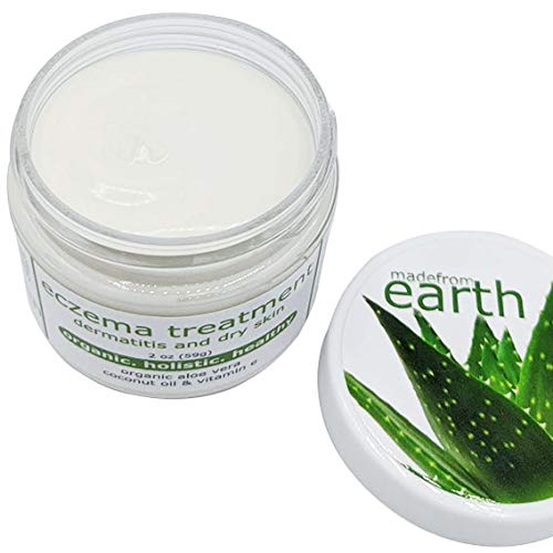 Made from Earth Eczema Cream for Dry Dermatitis Skin with Aloe & Vitamin E, 2oz