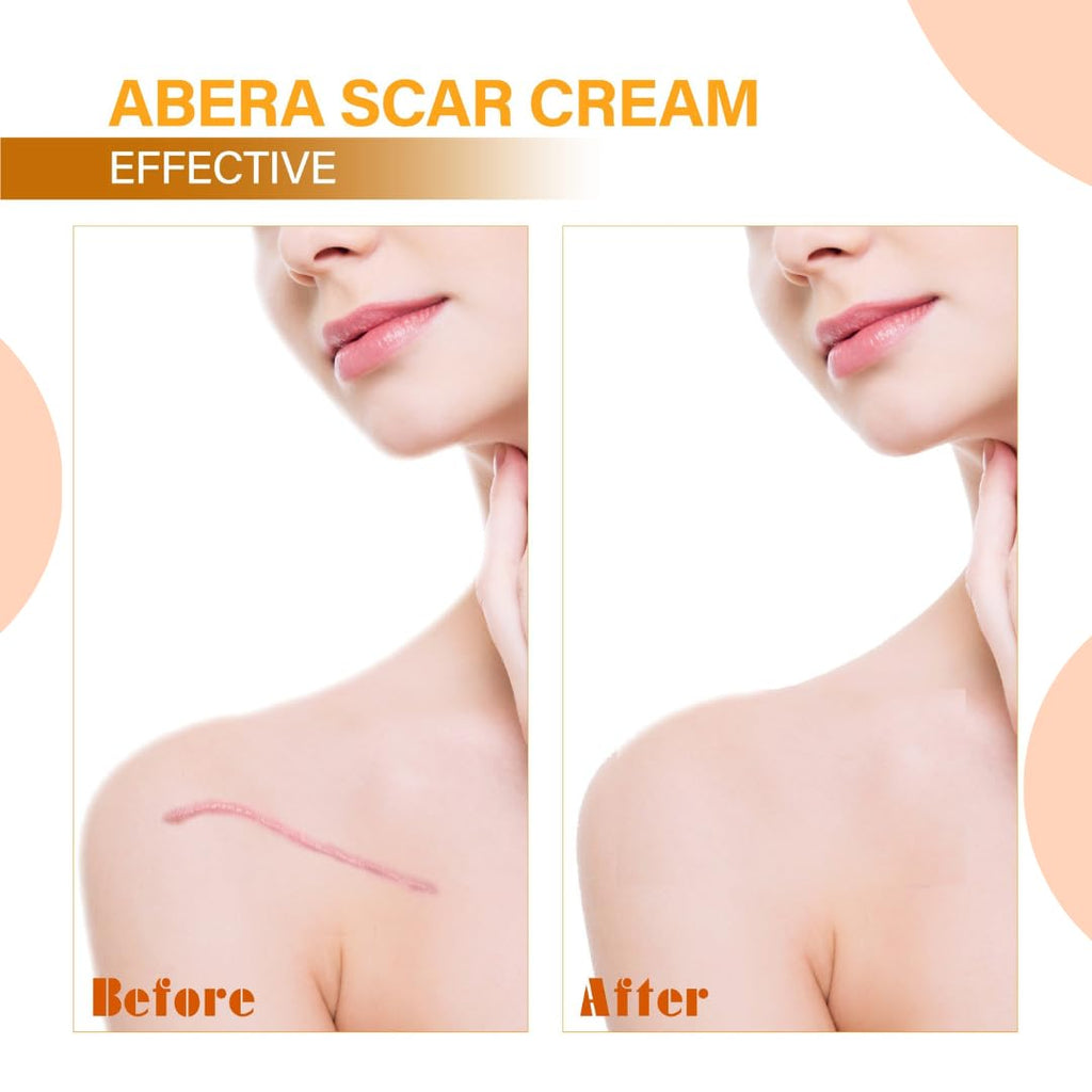 ABERA | Scar Red Turmeric Cream - Advanced Scar Treatment for Face and Body, Rapid Removal of Any Type of Scars with Natural Ing