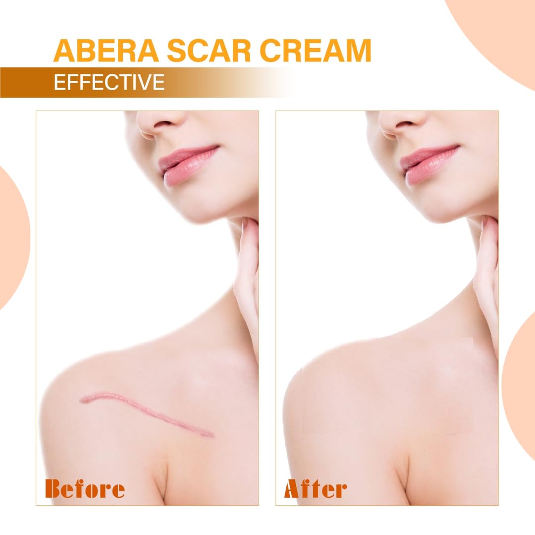 ABERA | Scar Red Turmeric Cream - Advanced Scar Treatment for Face and Body, Rapid Removal of Any Type of Scars with Natural Ing
