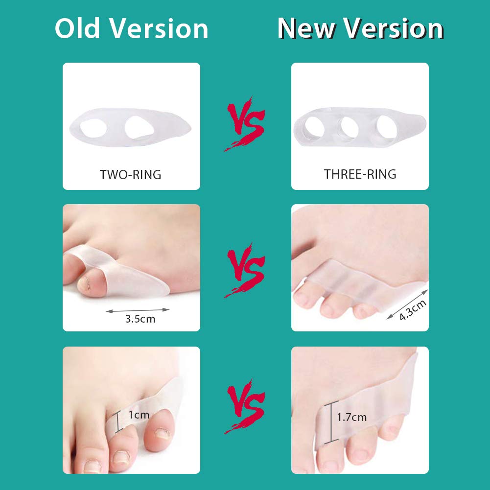 4Pcs Pinky Toe Separator, Toe Spacers, Soft Gel Toe Spacers Toe Corrector, Toe Separators for Overlapping Toes, Toe Straightener