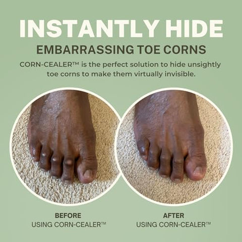 CORN-CEALER | Toe Corn Makeup | Instantly Hide Toe Corns | Full Coverage Makeup For Toe Corns | With Long-Lasting Matte Finish (