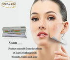 MEBO Burn (75 g) Cream Skin Ointment Wound & Scar Care Fast First Aid Health Beauty Care (1 Tube = 75 g)