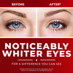Clear Eyes Maximum Strength Redness Relief Eye Drops, 2 Count