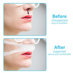 20 PCS Nasal Dressing Holders - Elastic External Nose Mesh Wound Bandage, Nasal Packing Retainers with Cotton Core, Post-Op Supp