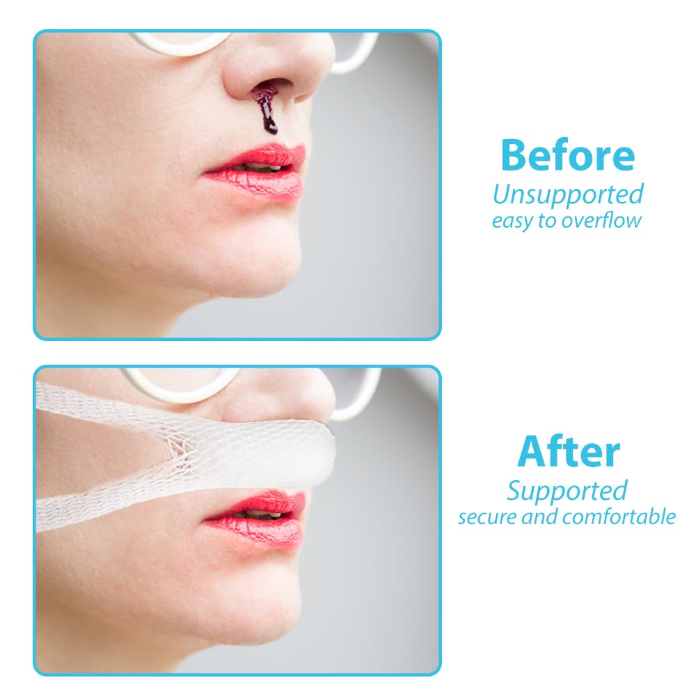20 PCS Nasal Dressing Holders - Elastic External Nose Mesh Wound Bandage, Nasal Packing Retainers with Cotton Core, Post-Op Supp