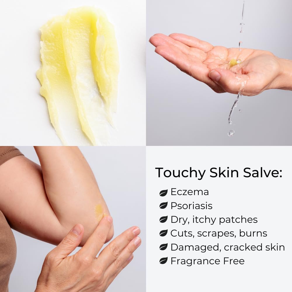 Touchy Skin Salve, Eczema Cream for Kids and Adults, Natural Sensitive Skin Treatment, Itch Cream, Calendula Ointment, 4 oz