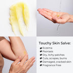 Touchy Skin Salve, Eczema Cream for Kids and Adults, Natural Sensitive Skin Treatment, Itch Cream, Calendula Ointment, 4 oz
