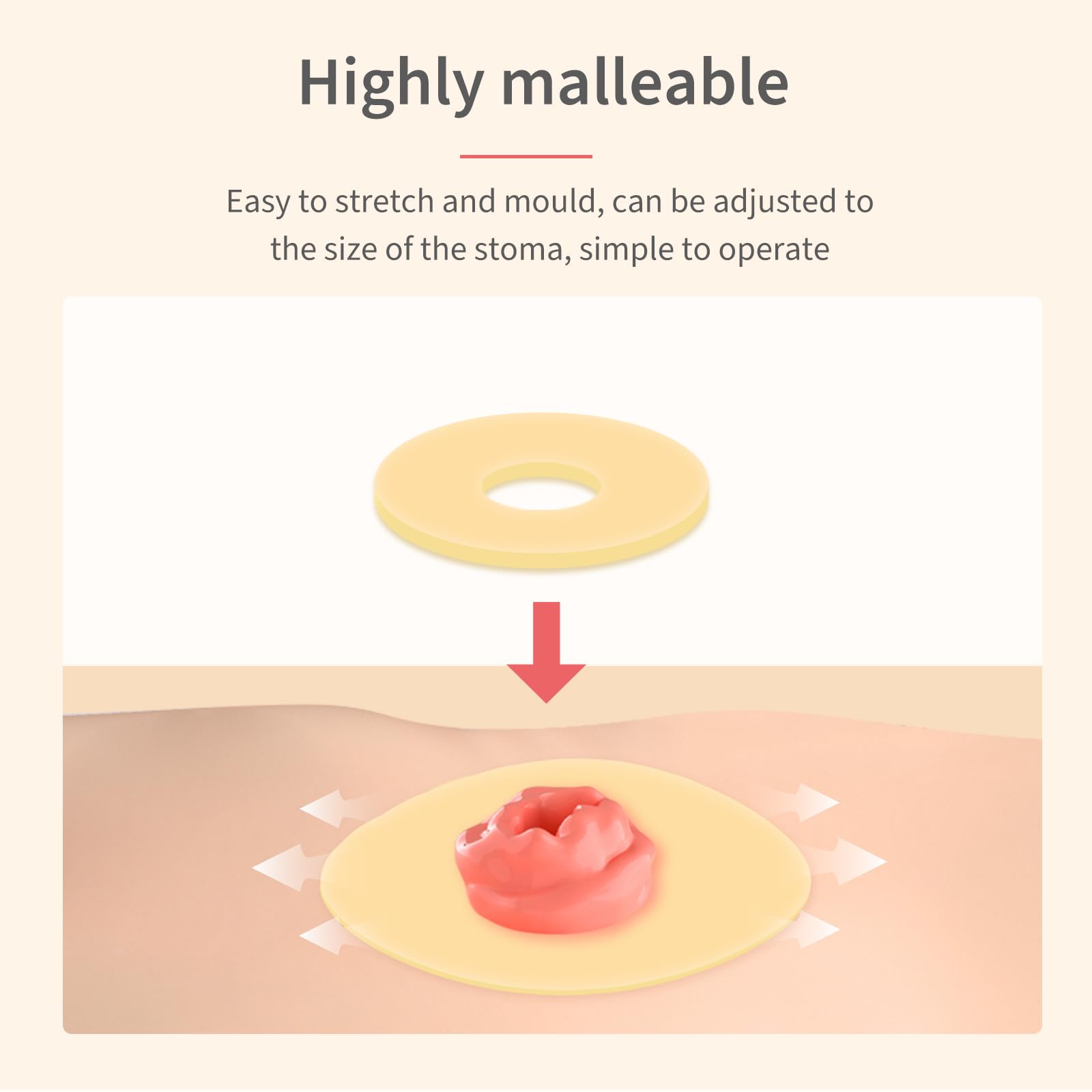 DERAYMI 30 Pack Moldable Ostomy Barrier Rings, 2mm Thickness Barrier Rings for Ostomy Bags, Sting-Free Hydrocolloid Ileostomy El