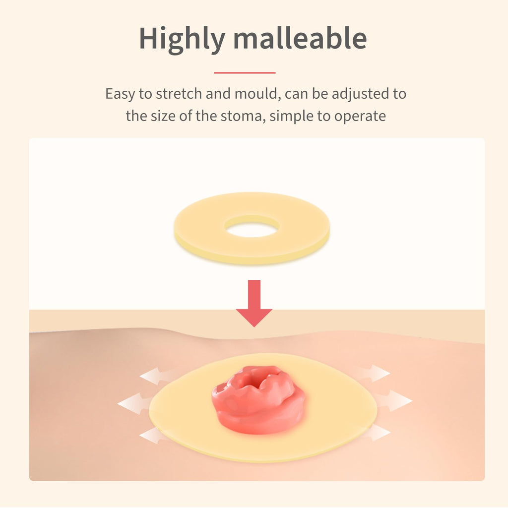 DERAYMI 10 Pack Moldable Ostomy Barrier Rings, 4mm Thickness Barrier Rings for Ostomy Bags, Sting-Free Hydrocolloid Ileostomy El