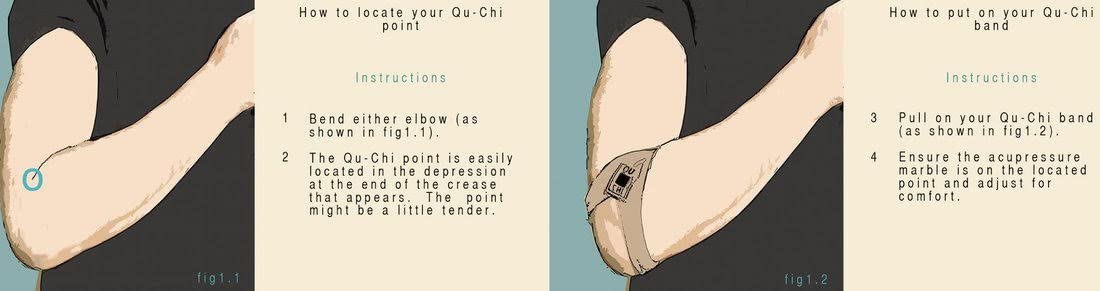 Qu-Chi Hayfever Band - The Acupressure Arm Band
