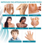 NewGel+ Advanced Silicone Scar Treatment Sheeting for OLD and NEW Scars, for Surgery, Injury, Keloids, C-Section, Burns, and Acn