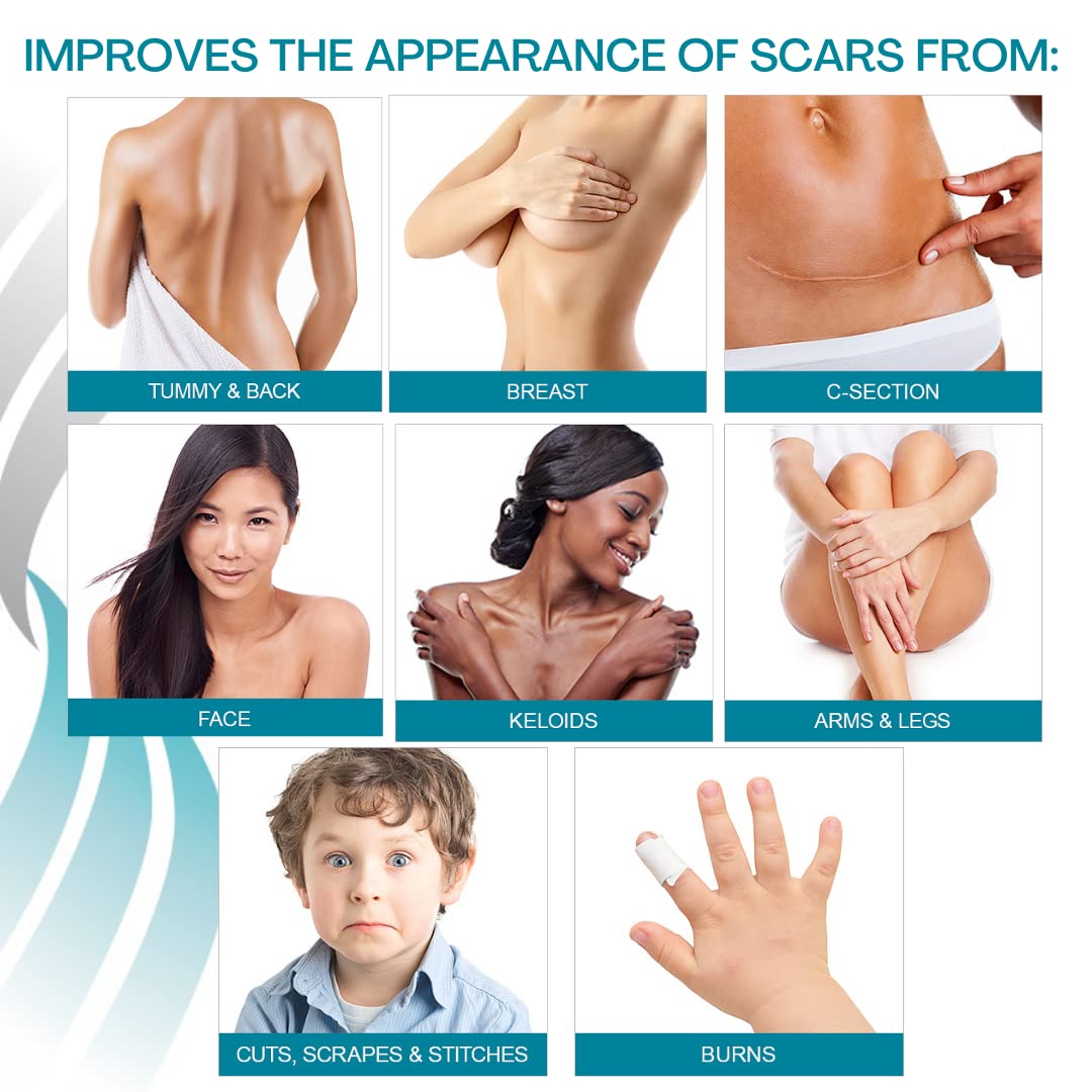 NewGel+ Advanced Silicone Scar Treatment Strip 1 mm Thick for Optimal Occlusion to Scars from Surgery, Injury, Keloids, Burns, R