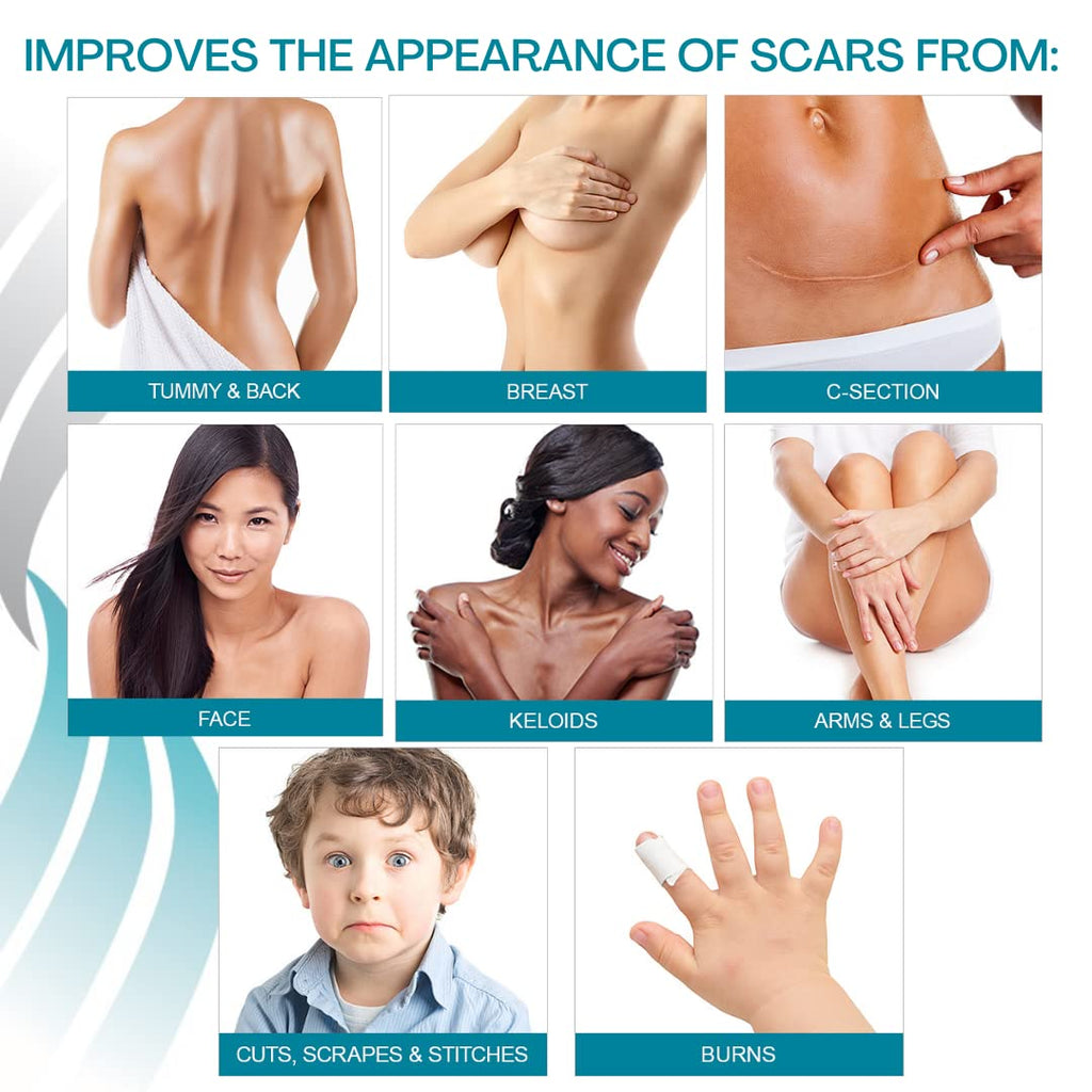 NewGel+ Advanced Silicone Scar Treatment Strip 1 mm Thick for Optimal Occlusion to Scars from Surgery, Injury, Keloids, Burns, R