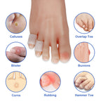Winiyou Silicone Small Toe Protectors Caps for Baby, Kids, Women and Men, 14 Pieces of Breathable Pinky Toe Covers for Corns, Bl