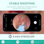 Earwax Camera Ear Camera Otoscope Cleaner, Oxbird 1080P Wireless Ear Wax Removal Kit Smart Ear Cleaner with Camera and Light for