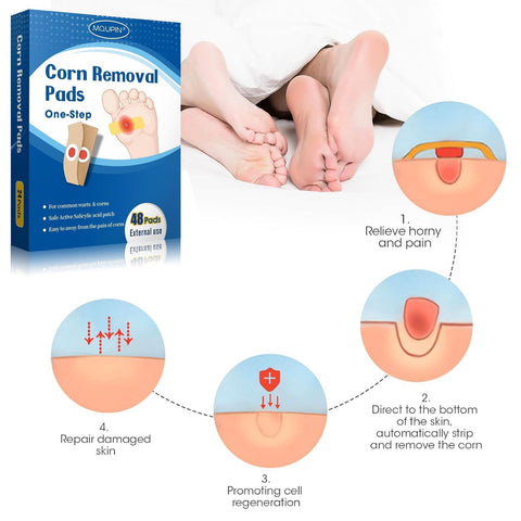 48 Count Corn Removal Pads for Feet and Toe, Corn Feet Remover for Extra Strength, Callous Remover