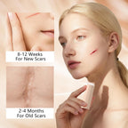 2pcs Silicone Scar Stick, Made of 60% Silicone,Gentle on All Skin Types
