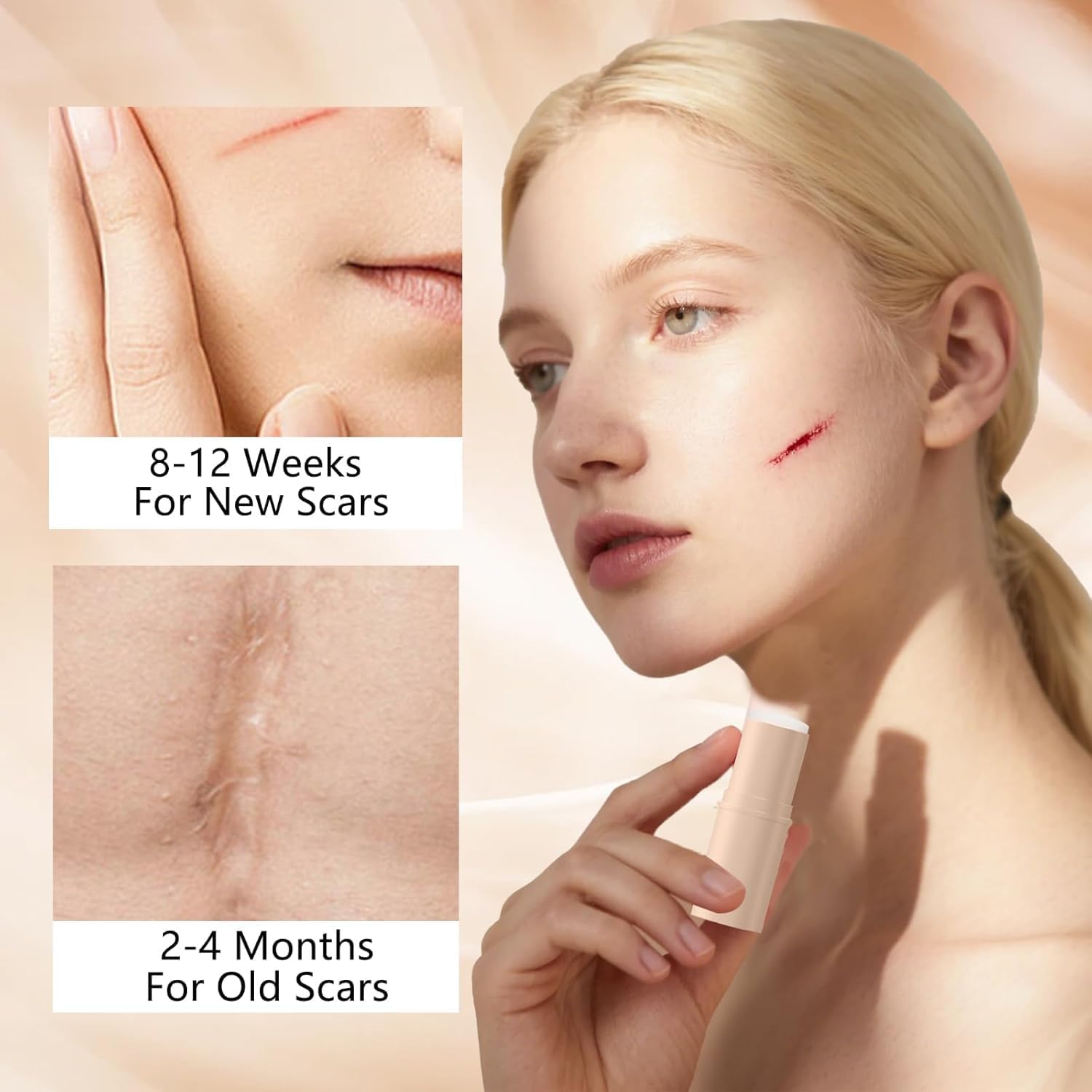 2pcs Silicone Scar Stick, Made of 60% Silicone,Gentle on All Skin Types