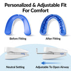 VitalSleep Anti-Snoring Mouthpiece, Comfortable & Adjustable Snore Guard, Quiets Snoring, USA Made, BPA Free & FDA Cleared Anti-