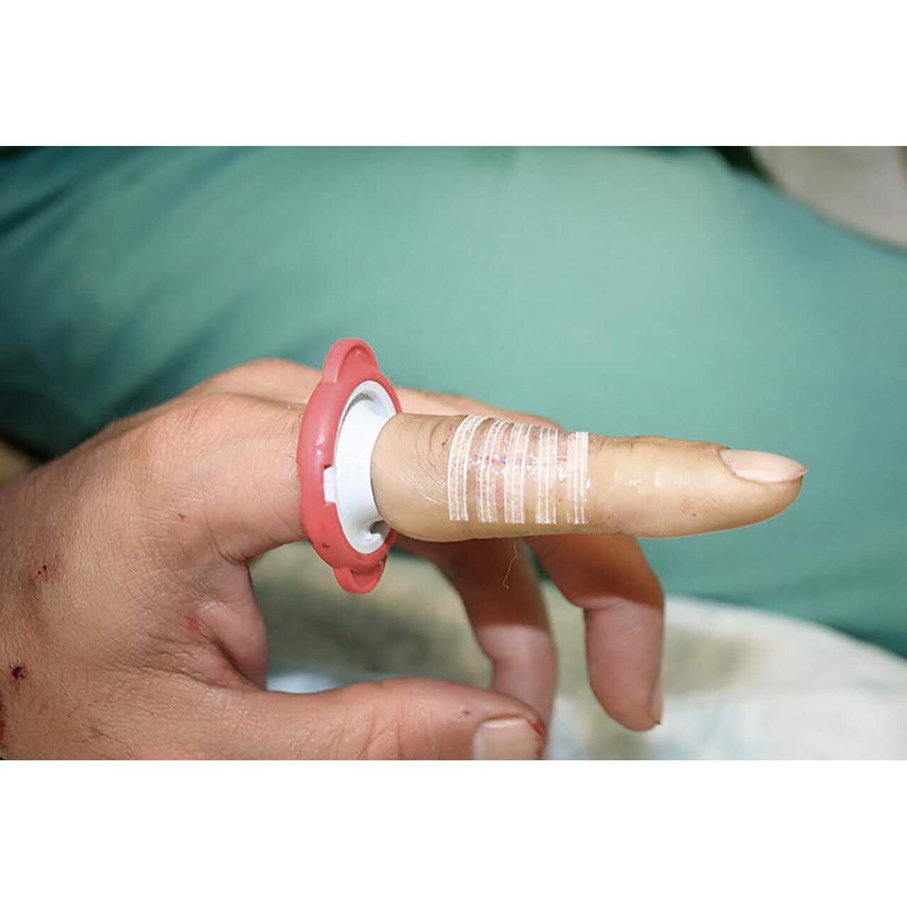 T-Ring Finger Cut Tourniquet