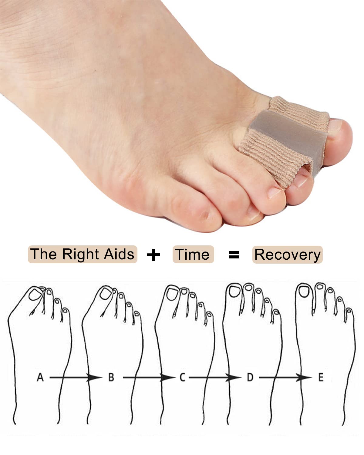 Golbylicc Bunion Toe Separators for Overlapping Toes Women Men, Gel Toe Spacers Bunion Corrector with 2 Loops for feet (4PC)