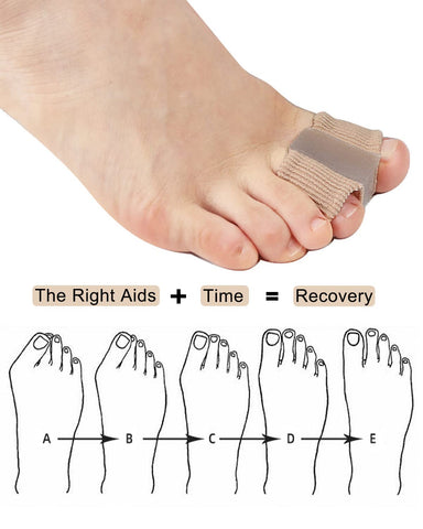 Golbylicc Bunion Toe Separators for Overlapping Toes Women Men, Gel Toe Spacers Bunion Corrector with 2 Loops for feet (4PC)