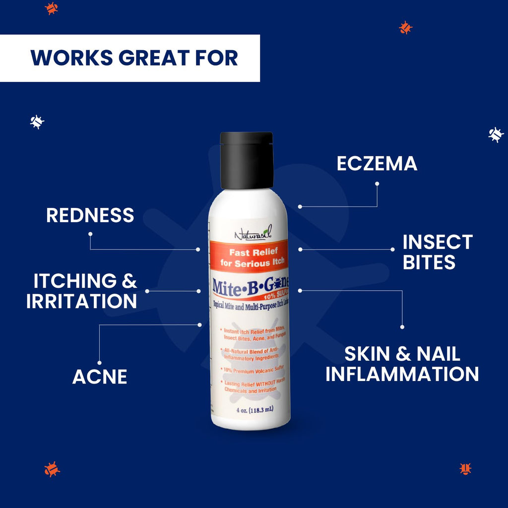 All-Natural Itch Relief by Mite-B-Gone - Sulfur Lotion Treatment for Acne, Bug Bites, Skin Redness & Itching, Discomfort & Rosac