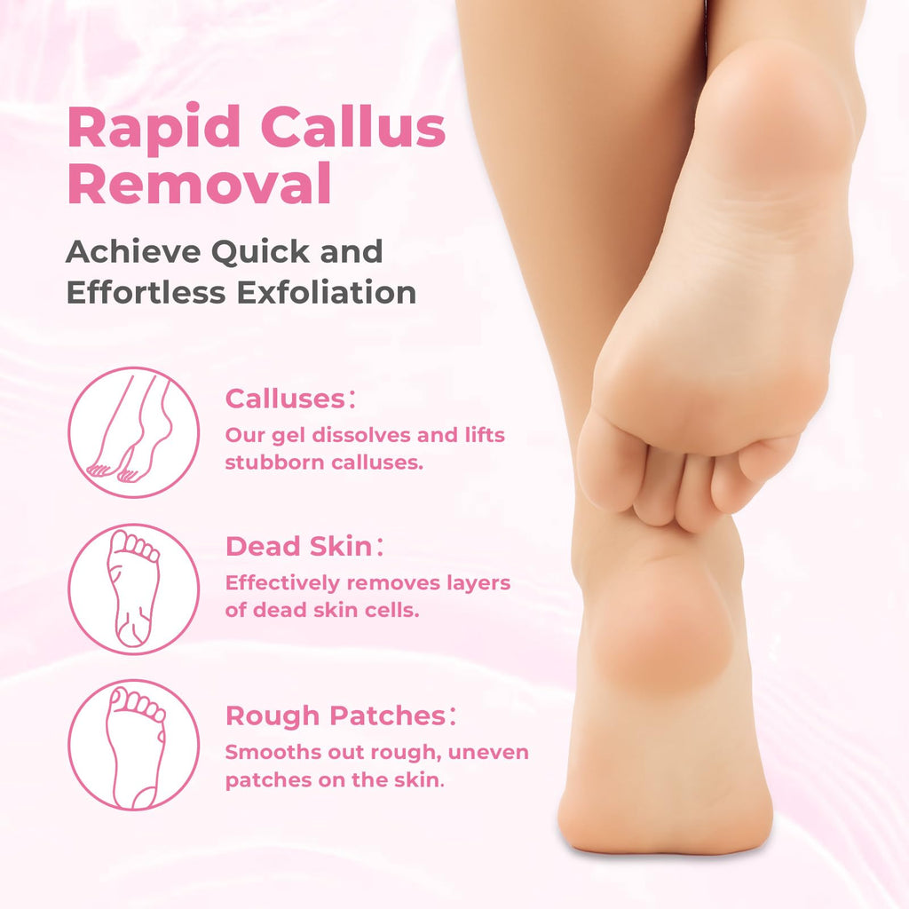 SAISZE Foot Callus Remover with Foot File, Extra Strength Callus Remover Gel with Brush Head, Professional Dead Skin Removal for
