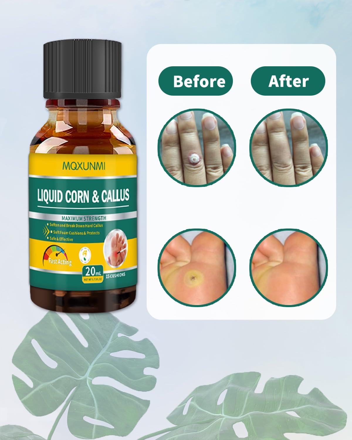 MQXUNMI Liquid Corn Removers for Feet, Maximum Strength Corn Removers for Toes, Fast Acting Liquid for Corn, Safe Foot Care with