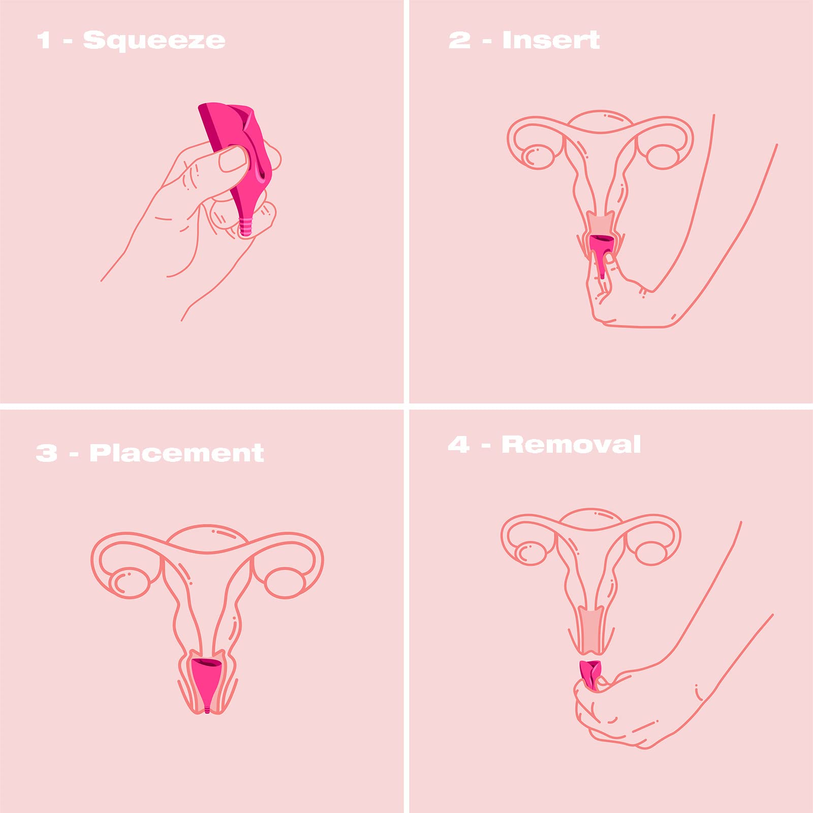 Intimina Lily Cup Size A - Ultra-Soft Menstrual Cup, Reusable Period Protection, Thin Menstrual Cup for up to 8 Hours, Medical-G