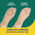 Dr. Scholl's CALLUS REMOVER Seal & Heal Bandage with Hydrogel Technology, 4ct // Removes Calluses Fast And Provides Cushioning P