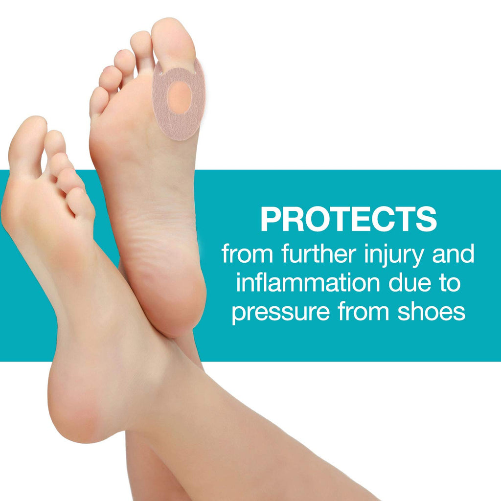 Steins 3/16 Removable Bunion Pads, Reusable Bunion Pads, Provides Bunion Relief, Corn Pads for Toes, Callus Pads, Felt Bunion Pa