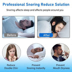 Forzacx Anti Snore Chin Strap - Breathable Chin Strap Snoring Solution, Effectively Reduce Snoring, Non-Stick Hair, Don't Fade -