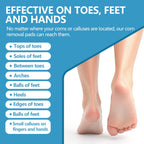 RHAICARE Corn removers for Toes feet Bottom of Foot Corn Remover,Corn Pads Callus Remover for Toes feet with 40% Salicylic 36 Co