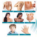 NewGel+ Advanced Silicone Professional Scar Treatment Tape for Abdomen and Extremity, Post Surgery, C-Section, Injury, Keloids,