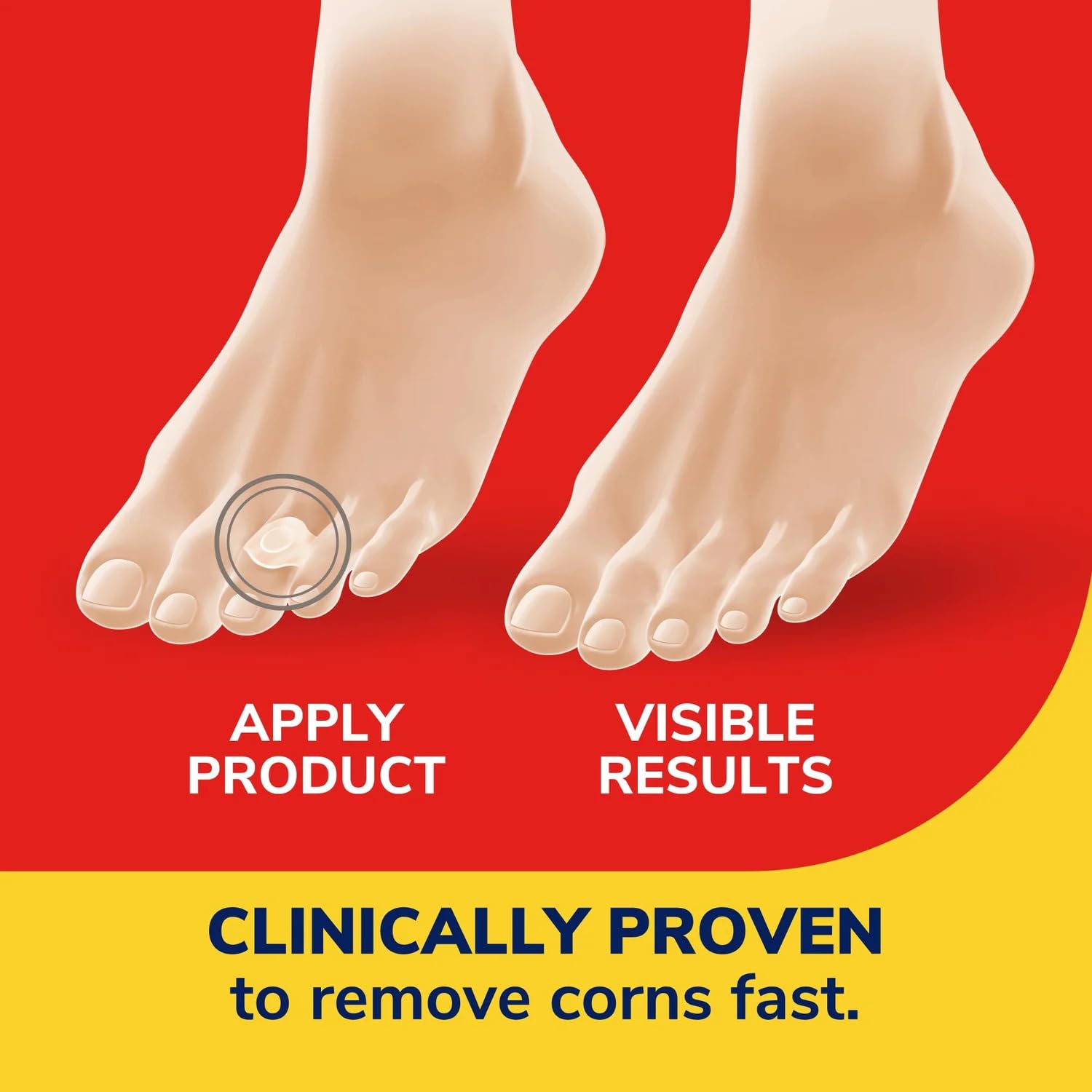 Dr. Scholl 's OneStep Corn Removers 6 Each