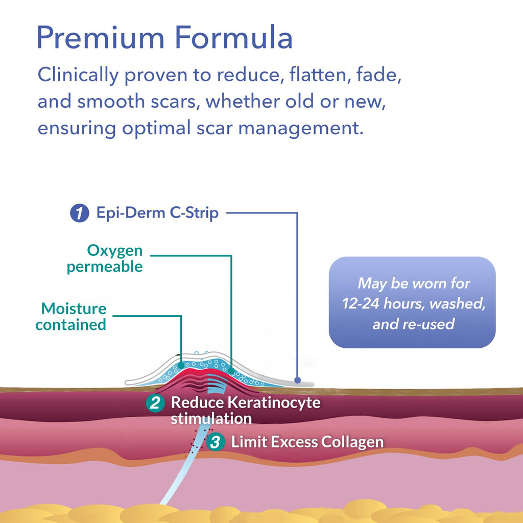 Biodermis Epi-Derm C-Strips, Silicone Gel Sheeting for Scars, Ideal for C-Section, Tummy Tuck, Hysterectomy & Cardiac Surgery Sc