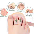 Welnove - Hammer Toes Straightener Toe Splint Corrector for Claw, Curled, Crooked Toe, Cushion Brace Joint Realign Metatarsal Su