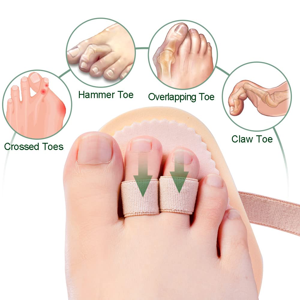 Welnove - Hammer Toes Straightener Toe Splint Corrector for Claw, Curled, Crooked Toe, Cushion Brace Joint Realign Metatarsal Su