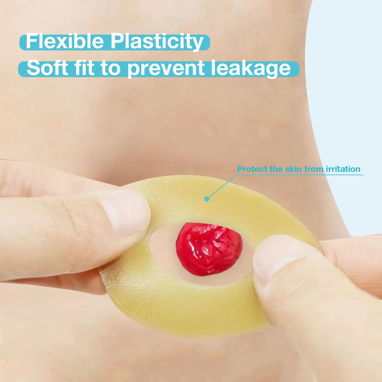 TNTNDAY 10 PCS Moldable Ostomy Barrier Rings, Elastic Skin Extender Rings, 2mm Thickness Medical Hydrocolloid Ostomy Bag Supplie