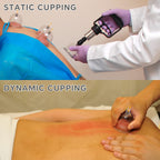 AIKOTOO Cupping Set Massage Therapy Cups Cupping Kit for Body Cellulite 24 Suction Cups