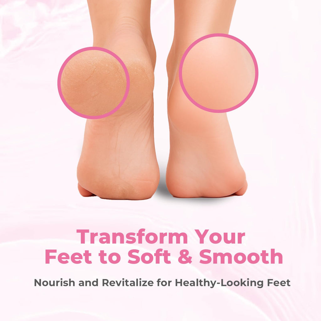 SAISZE Foot Callus Remover with Foot File, Extra Strength Callus Remover Gel with Brush Head, Professional Dead Skin Removal for